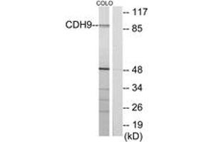 Western blot analysis of extracts from COLO cells, using CDH9 Antibody. (Cadherin 9 antibody  (AA 201-250))