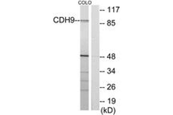 Cadherin 9 antibody  (AA 201-250)