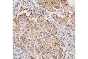 IHC analysis of PYROXD1 using anti-PYROXD1 antibody (ABIN6719650). (PYROXD1 antibody  (AA 48-230))