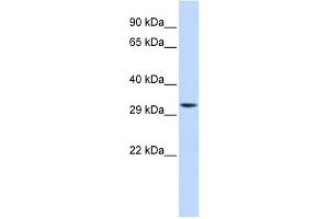 WB Suggested Anti-MTIF3 Antibody Titration: 0. (MTIF3 antibody  (Middle Region))