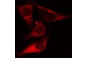 ABIN6275494 staining Hela cells by IF/ICC. (ARHGEF10 antibody  (Internal Region))