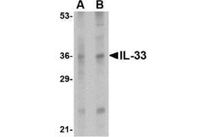 Western blot analysis of IL-33 in human lymph node tissue lysate with AP30427PU-N IL-33 antibody at (A) 1 and (B) 2 μg/ml. (IL-33 antibody  (Center))