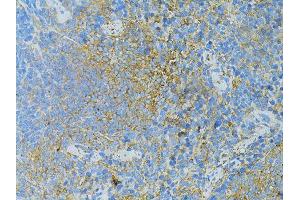 Immunohistochemistry of paraffin-embedded mouse slpeen using TLR4 antibody (ABIN5975781) at dilution of 1/100 (40x lens). (TLR4 antibody)
