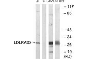 Western blot analysis of extracts from Jurkat/LOVO/NIH-3T3 cells, using LDLRAD2 Antibody. (LDLRAD2 antibody  (AA 130-179))