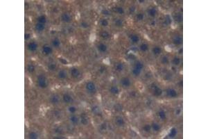 IHC-P analysis of Rat Tissue, with DAB staining. (LIPC antibody  (AA 191-466))
