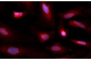 Immunofluorescence (IF) image for anti-Copper Chaperone For Superoxide Dismutase (CCS) (AA 1-274) antibody (APC) (ABIN5565328) (Superoxide dismutase copper chaperone antibody  (AA 1-274) (APC))