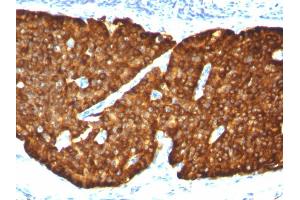 Immunohistochemistry (IHC) image for anti-Chromogranin A (CHGA) antibody (ABIN6939135)