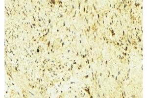 ABIN6276560 at 1/100 staining Mouse muscle tissue by IHC-P. (Tropomyosin antibody  (N-Term))