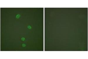 Immunofluorescence analysis of HepG2 cells, using MCM5 Antibody.