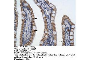 Human Intestine (PITX2 antibody  (N-Term))