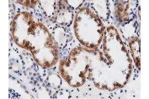 Immunohistochemical staining of paraffin-embedded Human Kidney tissue using anti-DNAJA2 mouse monoclonal antibody. (DNAJA2 antibody)