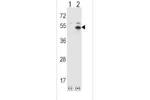 Western blot analysis of ST (arrow) using rabbit polyclonal ST Antibody  (ABIN388974 and ABIN2839216). (STAM antibody  (C-Term))