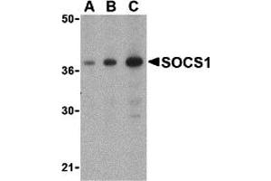 Western Blotting (WB) image for anti-Suppressor of Cytokine Signaling 1 (SOCS1) (C-Term) antibody (ABIN1030688) (SOCS1 antibody  (C-Term))