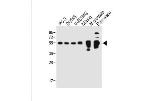 All lanes : Anti-AC Antibody (C-term) at 1:500 dilution Lane 1: PC-3 whole cell lysate Lane 2: D whole cell lysate Lane 3: U-251MG whole cell lysate Lane 4: Mouse lung whole tissue lysate Lane 5: Mouse prostate whole tissue lysate Lane 5: Rat prostate whole tissue lysate Lysates/proteins at 20 μg per lane. (ACPP antibody  (C-Term))