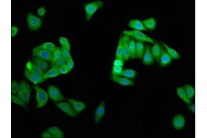 Immunofluorescence staining of HepG2 cells with ABIN7149816 at 1:66, counter-stained with DAPI. (DPPA5 antibody  (AA 1-116))