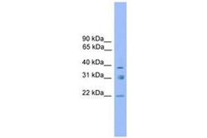 Image no. 1 for anti-Ring Finger Protein 167 (RNF167) (AA 179-228) antibody (ABIN6744738) (RNF167 antibody  (AA 179-228))