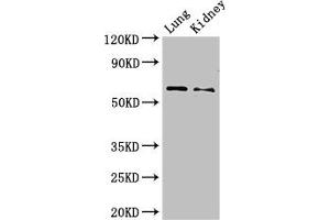 Western Blot Positive WB detected in: Mouse lung tissue, Mouse kidney tissue All lanes: Plbd2 antibody at 3 μg/mL Secondary Goat polyclonal to rabbit IgG at 1/50000 dilution Predicted band size: 66 kDa Observed band size: 66 kDa (PLBD2 antibody  (AA 36-585))