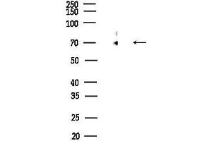 Western blot analysis of lysates from Rat testis, using CS Antibody at 1/1000 dilution.