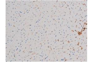 ABIN6267466 at 1/200 staining Mouse heart tissue sections by IHC-P. (CDC25A antibody  (pThr507))