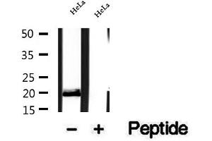 Western blot analysis of extracts of HeLa cells, using OPA3 antibody.