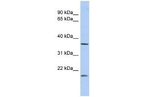 MTHFD2L antibody used at 1 ug/ml to detect target protein.