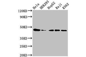 Western Blot Positive WB detected in: Hela whole cell lysate, HEK293 whole cell lysate, HepG2 whole cell lysate, Raji whole cell lysate, K562 whole cell lysate All lanes: CSNK2A1 antibody at 3 μg/mL Secondary Goat polyclonal to rabbit IgG at 1/50000 dilution Predicted band size: 46, 30 kDa Observed band size: 46 kDa (CSNK2A1/CK II alpha antibody  (AA 1-391))
