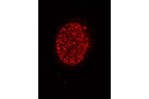 Histone H4 acetyl Lys5 antibody tested by immunofluorescence. (Histone H4 antibody  (acLys5))