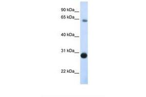 Image no. 1 for anti-Der1-Like Domain Family, Member 3 (DERL3) (C-Term) antibody (ABIN6738122) (Derlin-3 antibody  (C-Term))