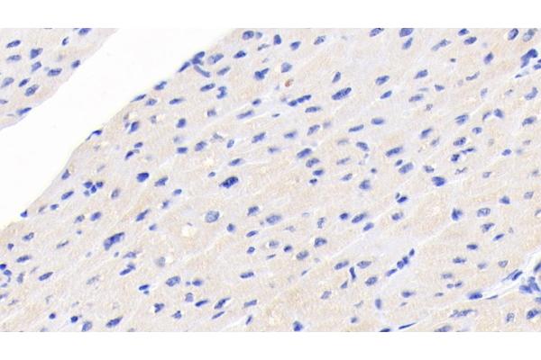NT-ProBNP antibody  (AA 27-102)