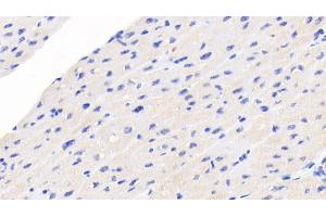 Detection of NT-ProBNP in Human Cardiac Muscle Tissue using Monoclonal Antibody to N-Terminal Pro-Brain Natriuretic Peptide (NT-ProBNP) (NT-ProBNP antibody  (AA 27-102))