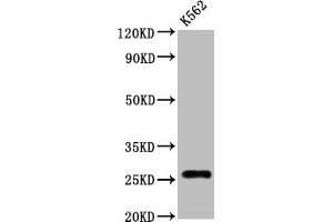 Western Blot Positive WB detected in:K562 whole cell lysate All lanes:CD81 antibody at 1.