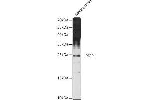 Western blot analysis of extracts of mouse brain, using PIGP antibody (ABIN6292034) at 1:1000 dilution. (PIGP antibody)