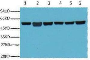 Western Blot (WB) analysis of A549 (1), Rat Brain (2), Mouse Brain (3), Chicken lung (4) and Rabbit testis (5), Sheep muscle (6), diluted at 1:5000. (TUBB antibody)