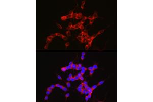 Immunofluorescence analysis of SH-SY5Y cells using NPY5R Rabbit mAb (ABIN7268890) at dilution of 1:100 (40x lens). (NPY5R antibody)