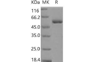 Western Blotting (WB) image for Myeloproliferative Leukemia Virus Oncogene (MPL) protein (His tag) (ABIN7321113) (MPL Protein (His tag))