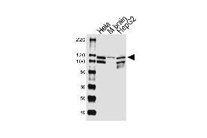 Western blot analysis of lysates from Hela cell line, mouse brain tissue lysate, HepG2 cell line (from left to right), using UBE3CAntibody (Center) (ABIN1881969 and ABIN2843383). (UBE3C antibody  (AA 549-578))