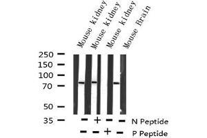 Western blot analysis of Phospho-RelB (Ser552) expression in various lysates (RELB antibody  (pSer573))
