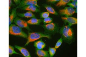 HeLa cell cultures stained with ABIN1580461 (green) and ’s chicken polyclonal antibody to vimentin: CPCA-Vim (red). (Ubiquilin 2 antibody)