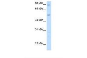 Image no. 2 for anti-Alanine Aminotransferase (ALT) (AA 31-80) antibody (ABIN320978) (ALT antibody  (AA 31-80))