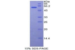 SDS-PAGE (SDS) image for Adenosine Deaminase (ADA) (AA 11-280) protein (His tag) (ABIN2122356)