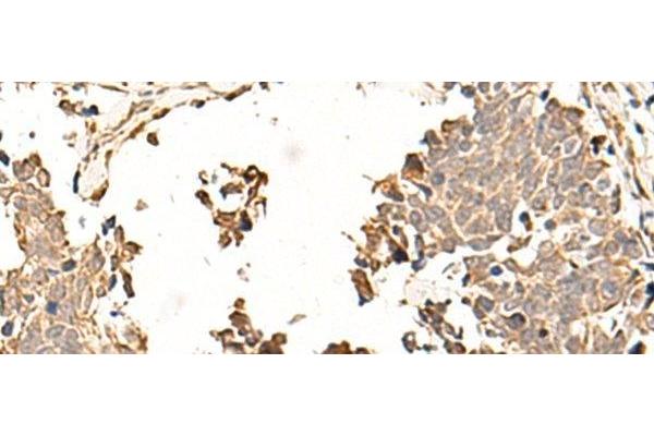 SOX3 antibody