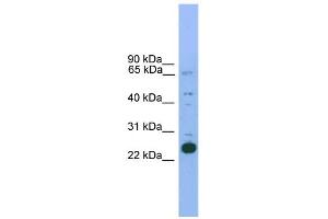 WB Suggested Anti-Nkx2-6 Antibody Titration: 0. (NKX2-6 antibody  (N-Term))