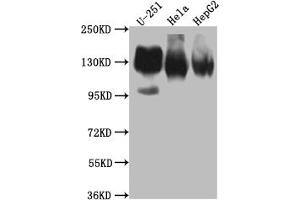 Western Blot Positive WB detected in: U-251 whole cell lysate, Hela whole cell lysate, HepG2 whole cell lysate All lanes: ITGAV antibody at 1:1000 Secondary Goat polyclonal to rabbit IgG at 1/50000 dilution Predicted band size: 117, 113, 112 kDa Observed band size: 130 kDa (Recombinant CD51 antibody)