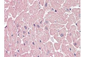 Human Heart (formalin-fixed, paraffin-embedded) stained with ARHGEF17 antibody LAP22665PU-N at 5 µg/ml followed by biotinylated goat anti-rabbit IgG secondary antibody, alkaline phosphatase-streptavidin and chromogen. (ARHGEF17 antibody)