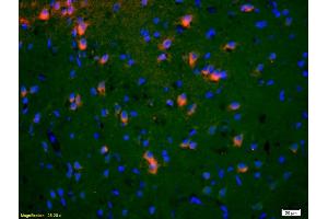 Formalin-fixed and paraffin-embedded rat brain labeled with Anti-EphA5/Eph receptor A5 Polyclonal Antibody, Unconjugated (ABIN718661) 1:200, overnight at 4°C, The secondary antibody was Goat Anti-Rabbit IgG, Cy3 conjugated used at 1:200 dilution for 40 minutes at 37°C. (EPH Receptor A5 antibody  (AA 451-550))
