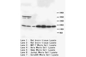 Image no. 1 for anti-S100 Calcium Binding Protein B (S100B) (C-Term) antibody (ABIN1493108) (S100B antibody  (C-Term))
