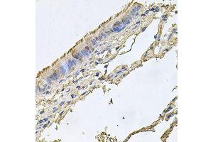 Immunohistochemistry of paraffin-embedded human trachea using FABP12 antibody (ABIN6003626) at dilution of 1/100 (40x lens). (FABP12 antibody)