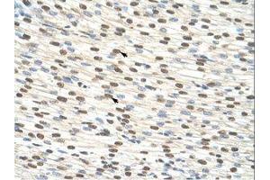 Image no. 3 for anti-Zinc Finger Protein 274 (ZNF274) (AA 87-136) antibody (ABIN203353) (ZNF274 antibody  (AA 87-136))