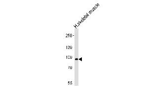 Western blot analysis of lysate from human skeletal muscle tissue lysate, using PFKM Antibody （S137） at 1:1000 at each lane. (PFKM antibody  (N-Term))