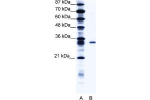 WB Suggested Anti-KCNIP4 Antibody   Titration: 1. (KCNIP4 antibody  (N-Term))